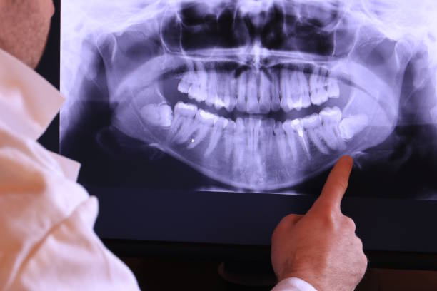 Teeth Whitening in NM