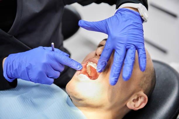Best Teeth Whitening  in La Plata, NM